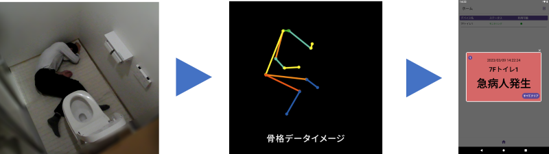 Xeye骨格分析イメージ
